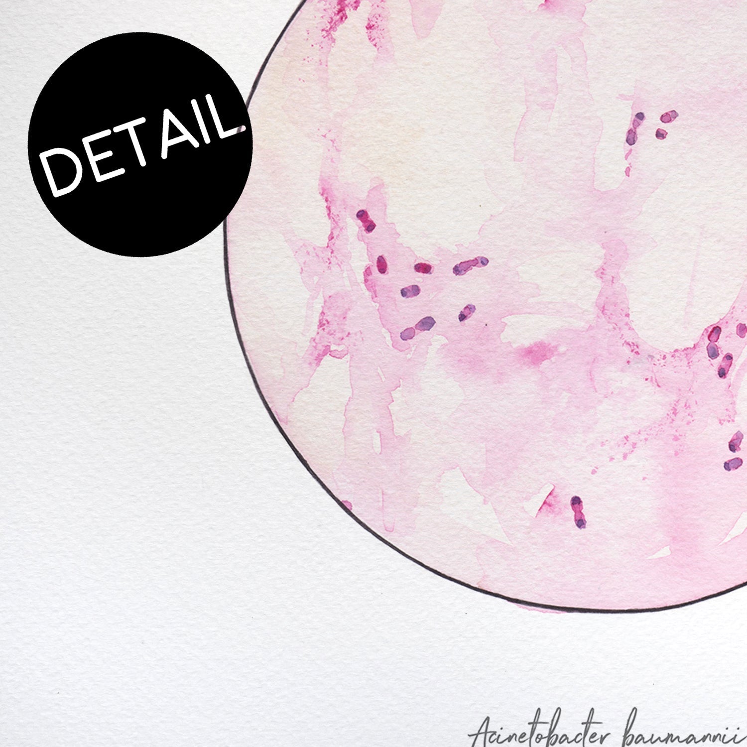 Up close detail of Acinetobacter baumanii