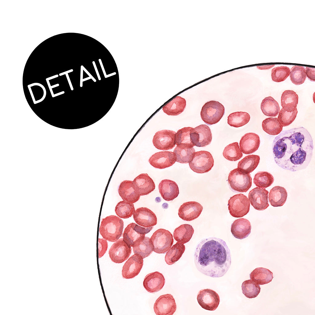 Blood Smear 3 - Sandra Black Culliton