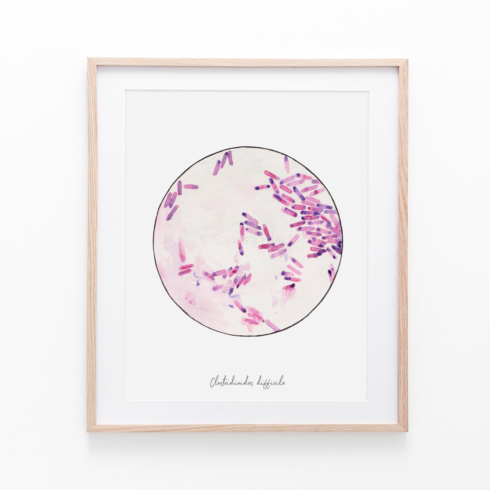 Clostridioides fine art print
