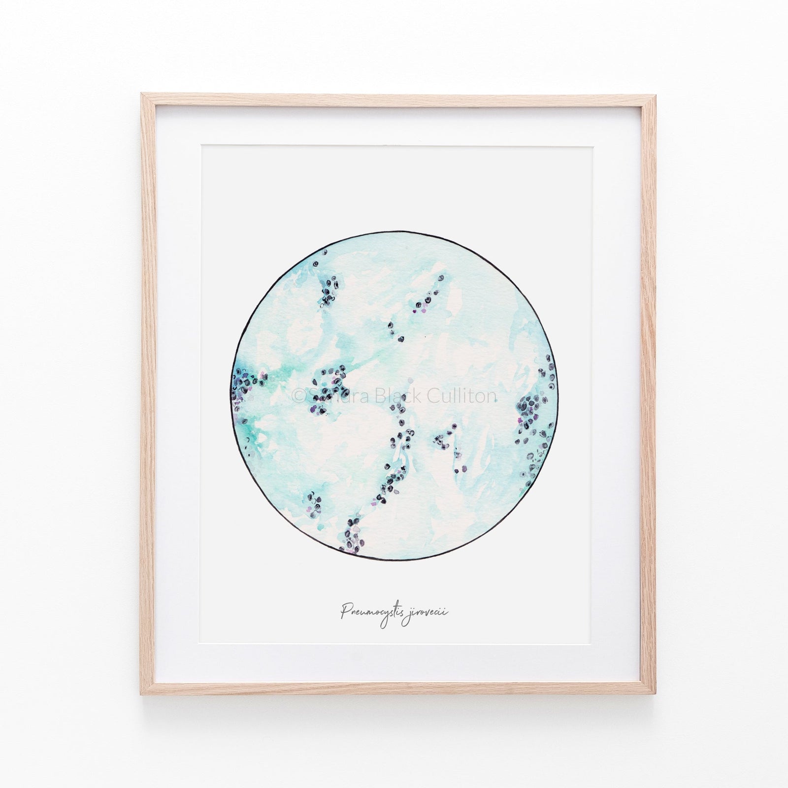 Pneumocystis jirovici print framed