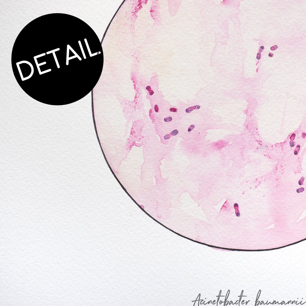 Up close detail of Acinetobacter baumanii