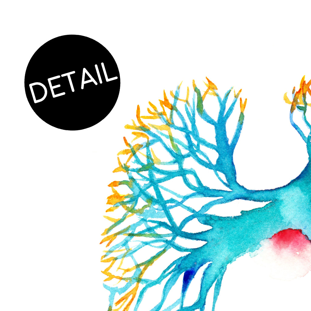 Pulmonary Angiogram,[product type] - Sandra Black Science Art