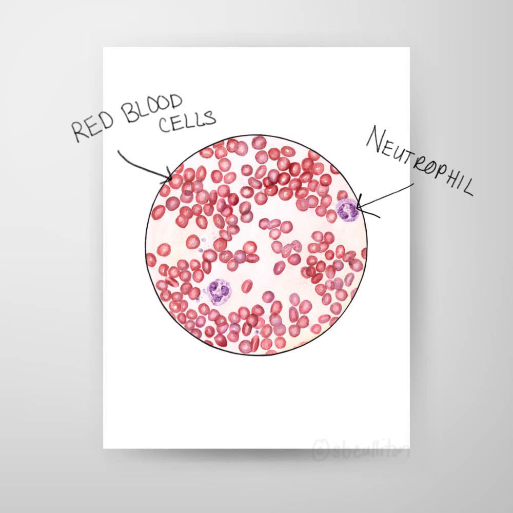 Blood Smear 1,[product type] - Sandra Black Science Art