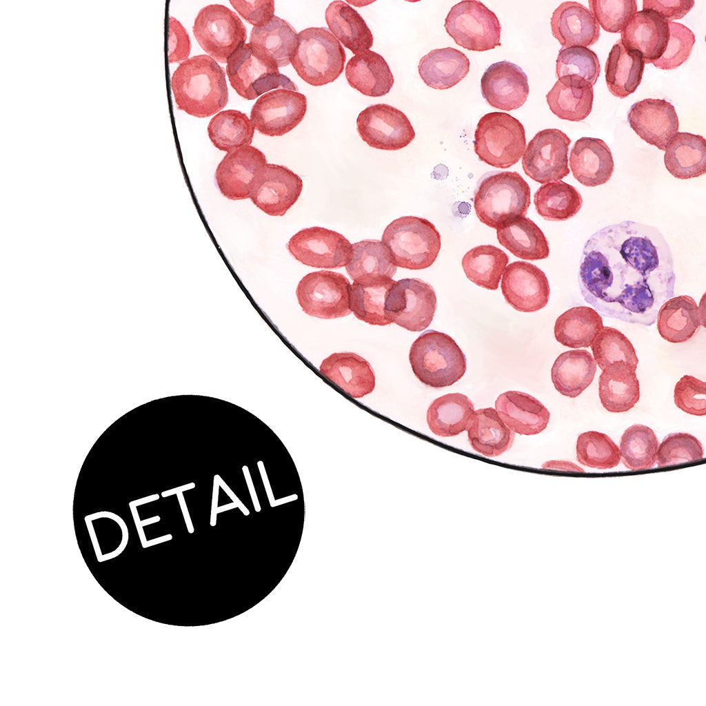 Blood Smear 2,[product type] - Sandra Black Science Art