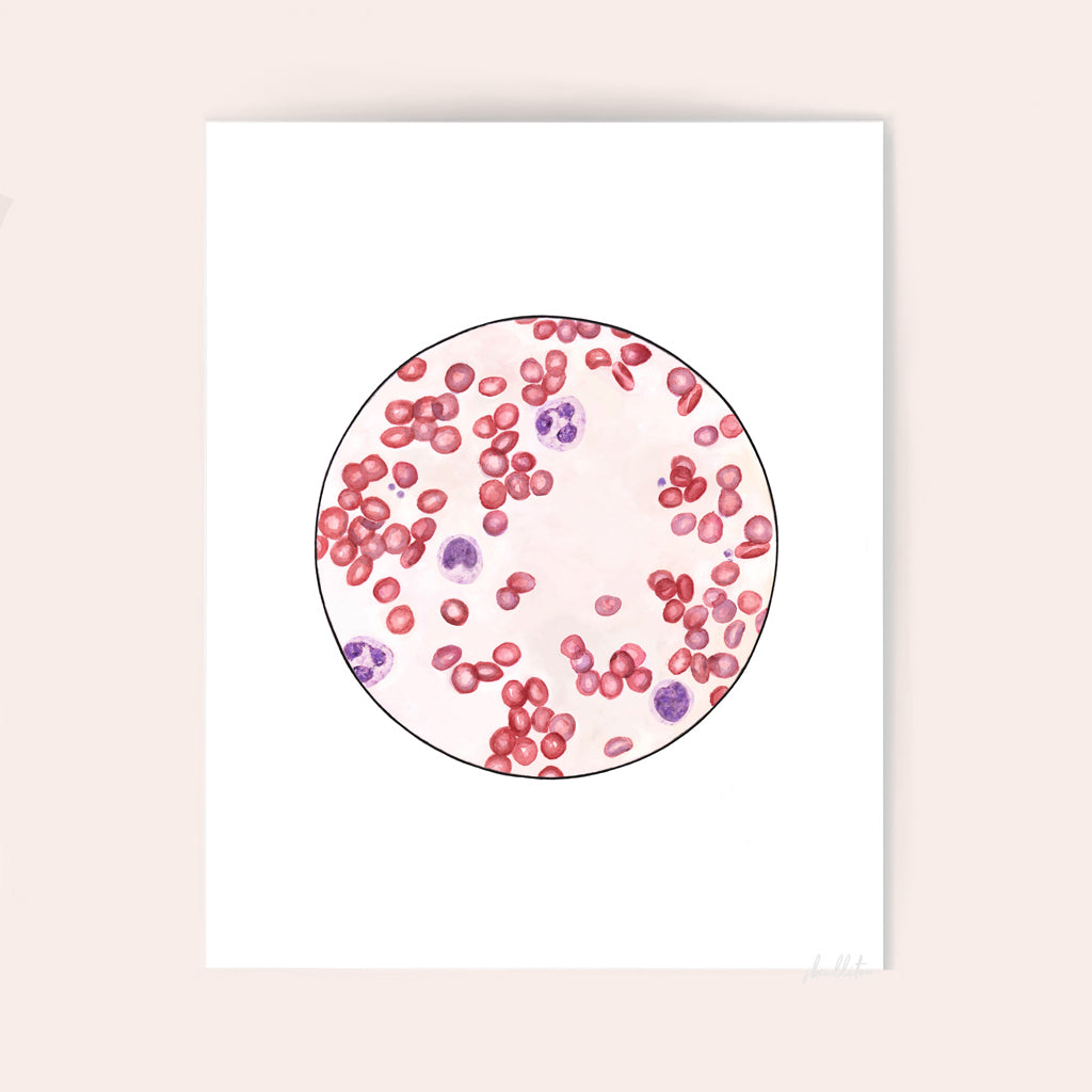 Blood Smear 3 - Sandra Black Culliton