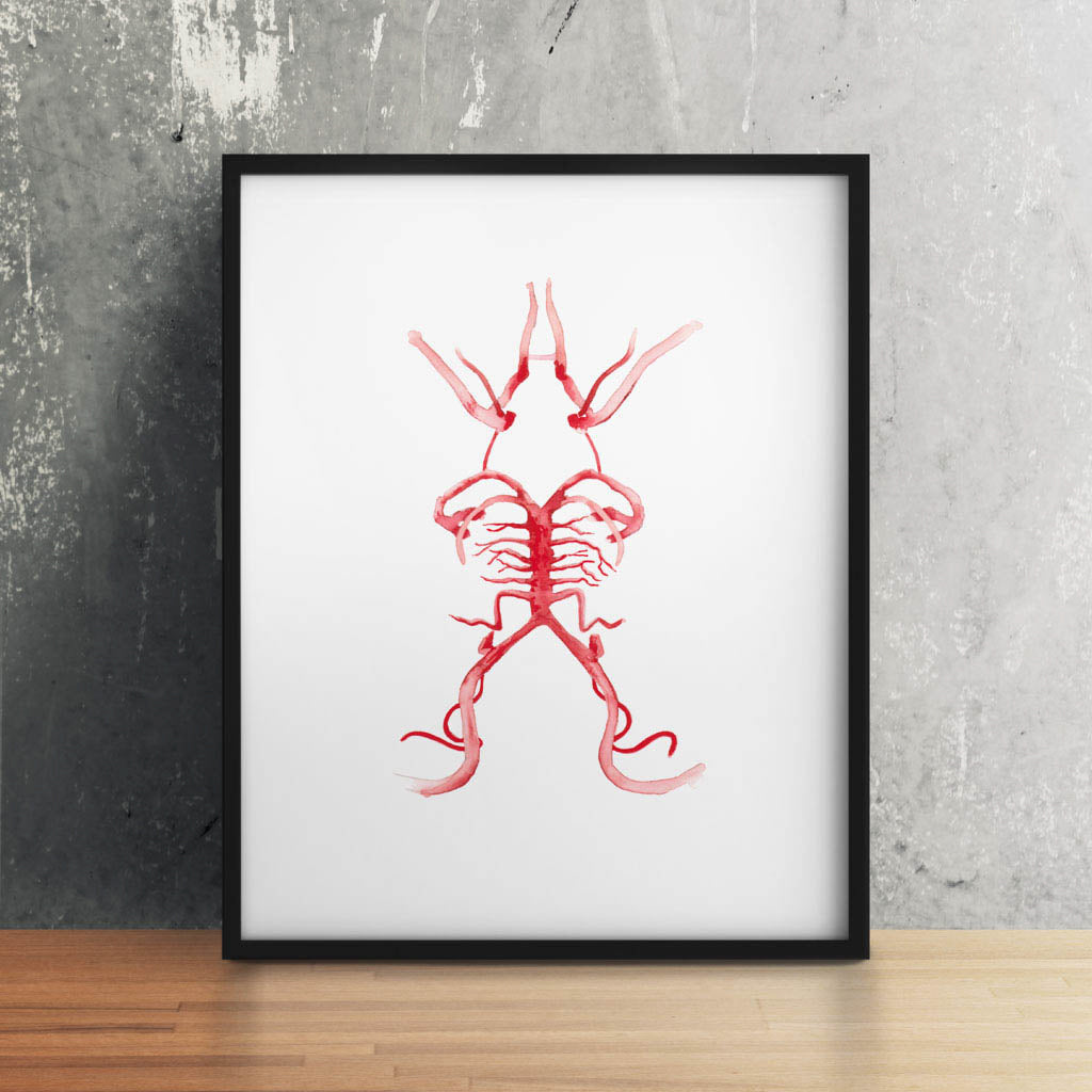 Circle of Willis,[product type] - Sandra Black Science Art