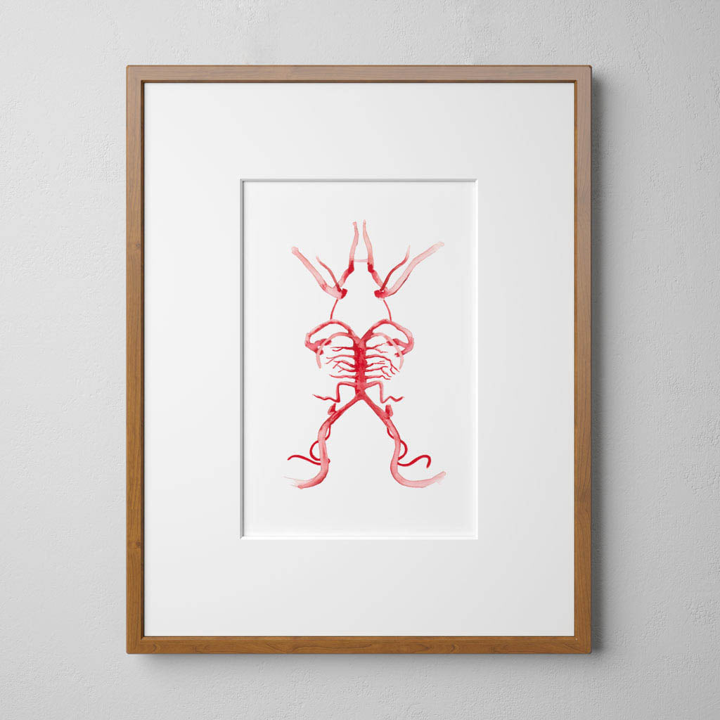 Circle of Willis,[product type] - Sandra Black Science Art