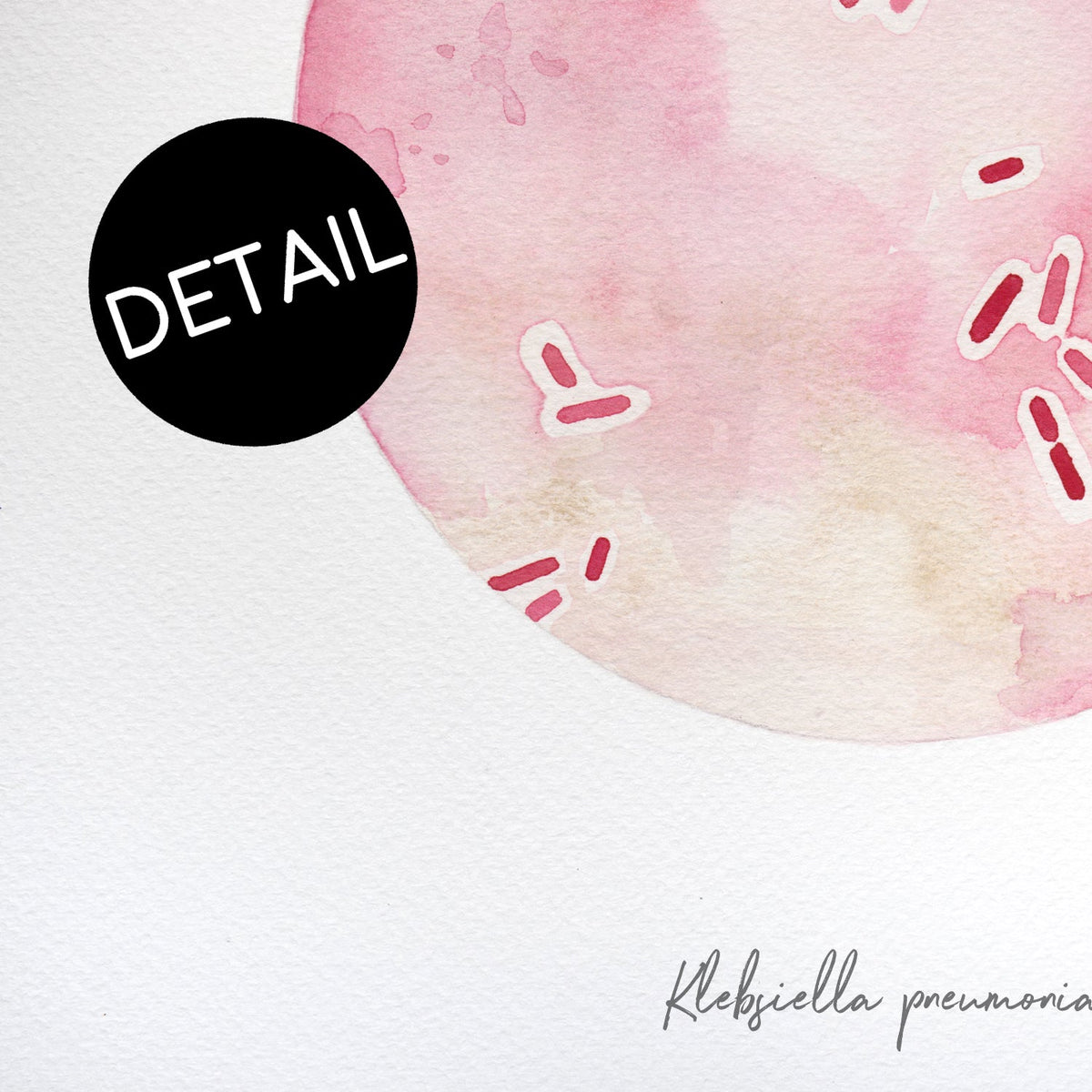 Klebsiella pneumoniae print detail