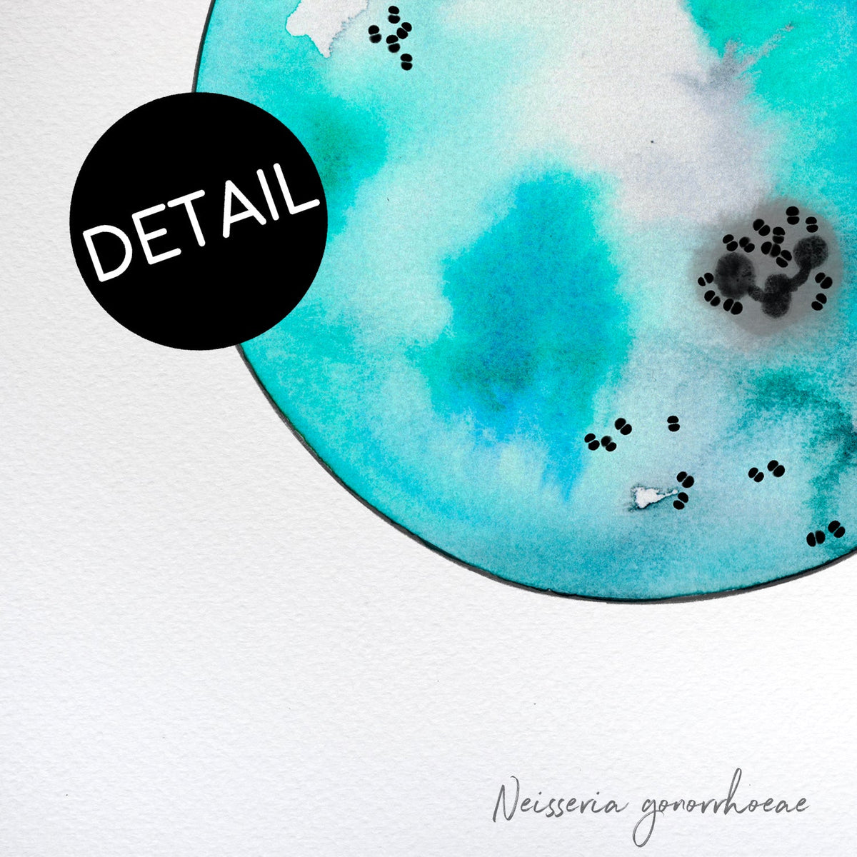 Neisseria gonorrhoaea print detail