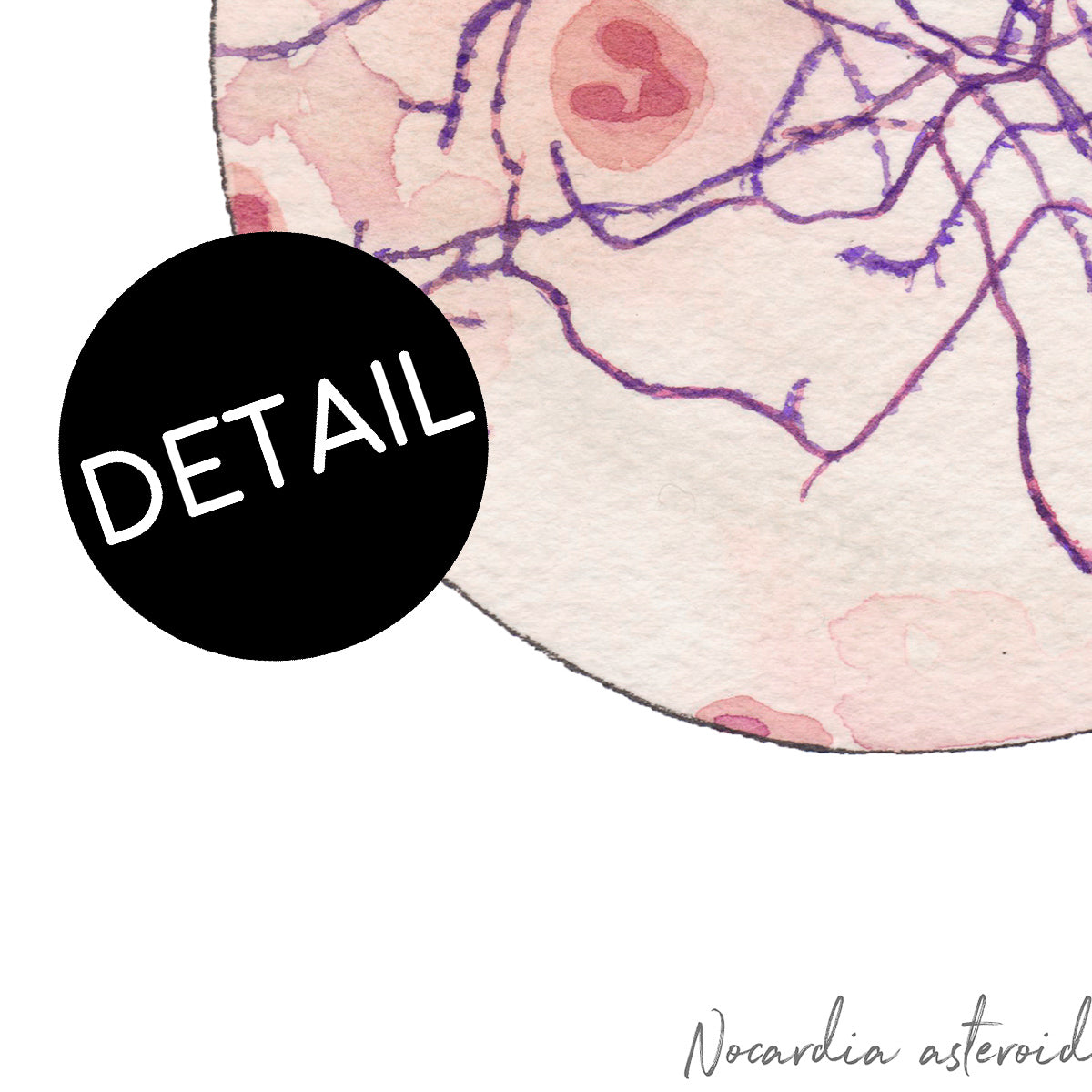 Nocardia asteroides art print up close detail.