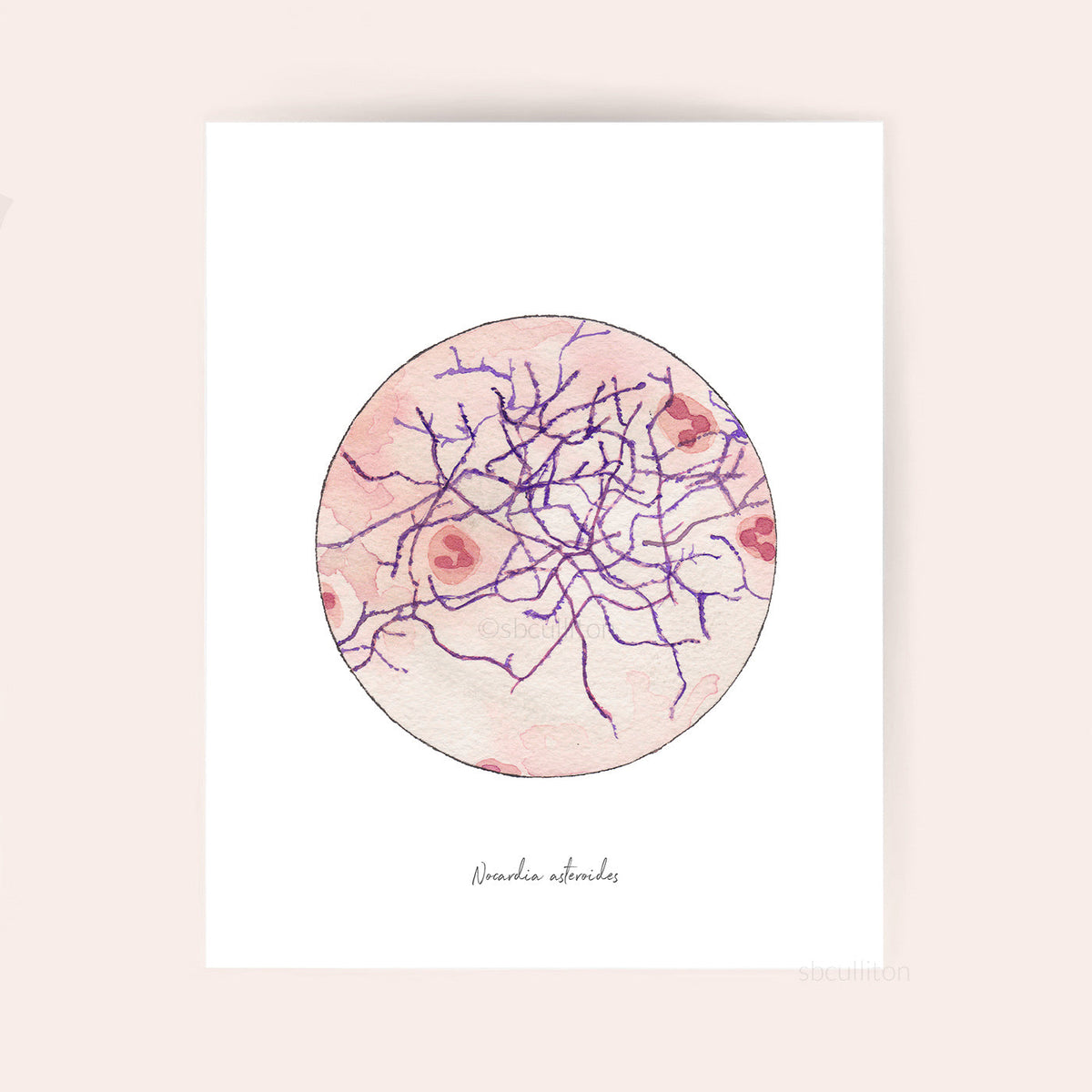 Nocardia asteroides fine art print