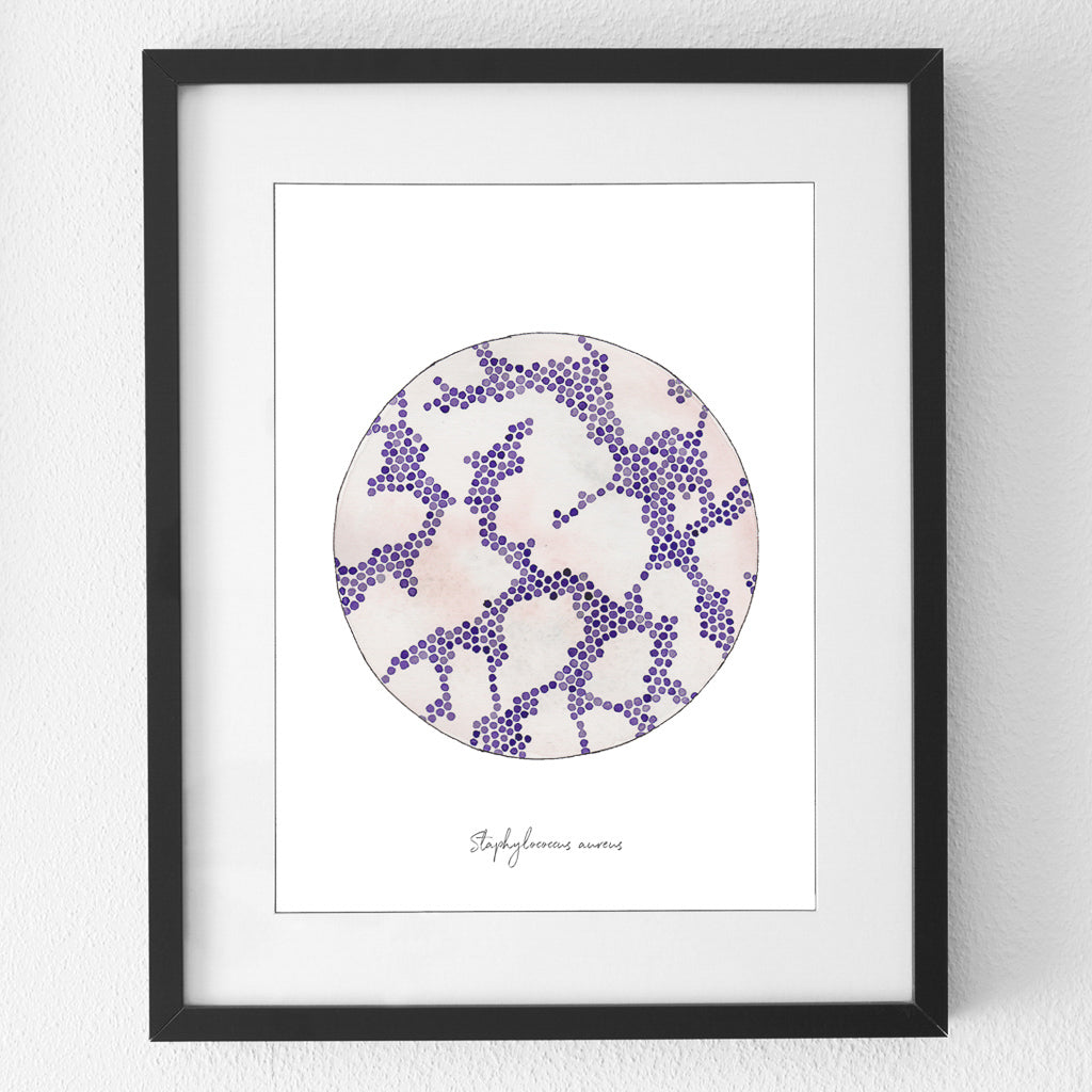 Staphylococcus aureus watercolor print in black frame against white wall.