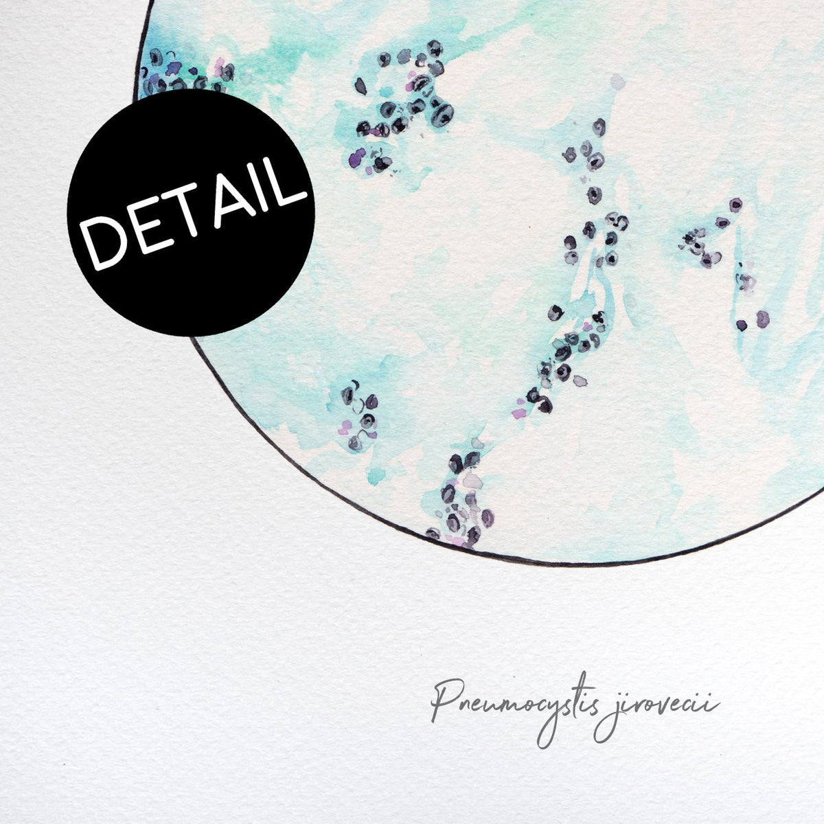 Pneumocystis print detail