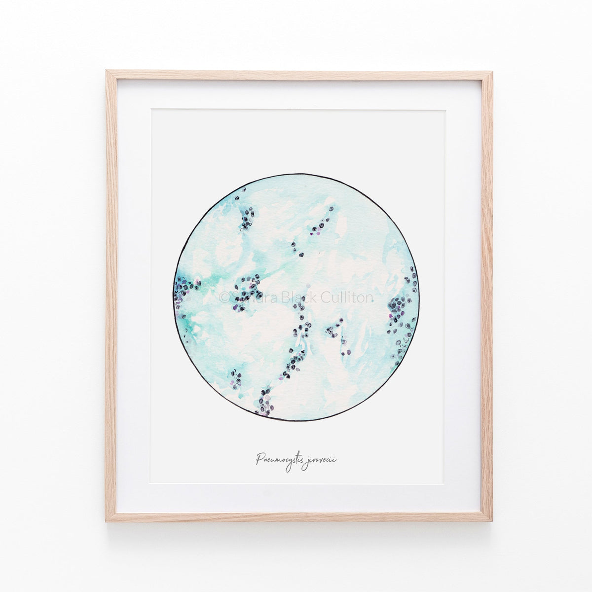 Pneumocystis jirovici print framed