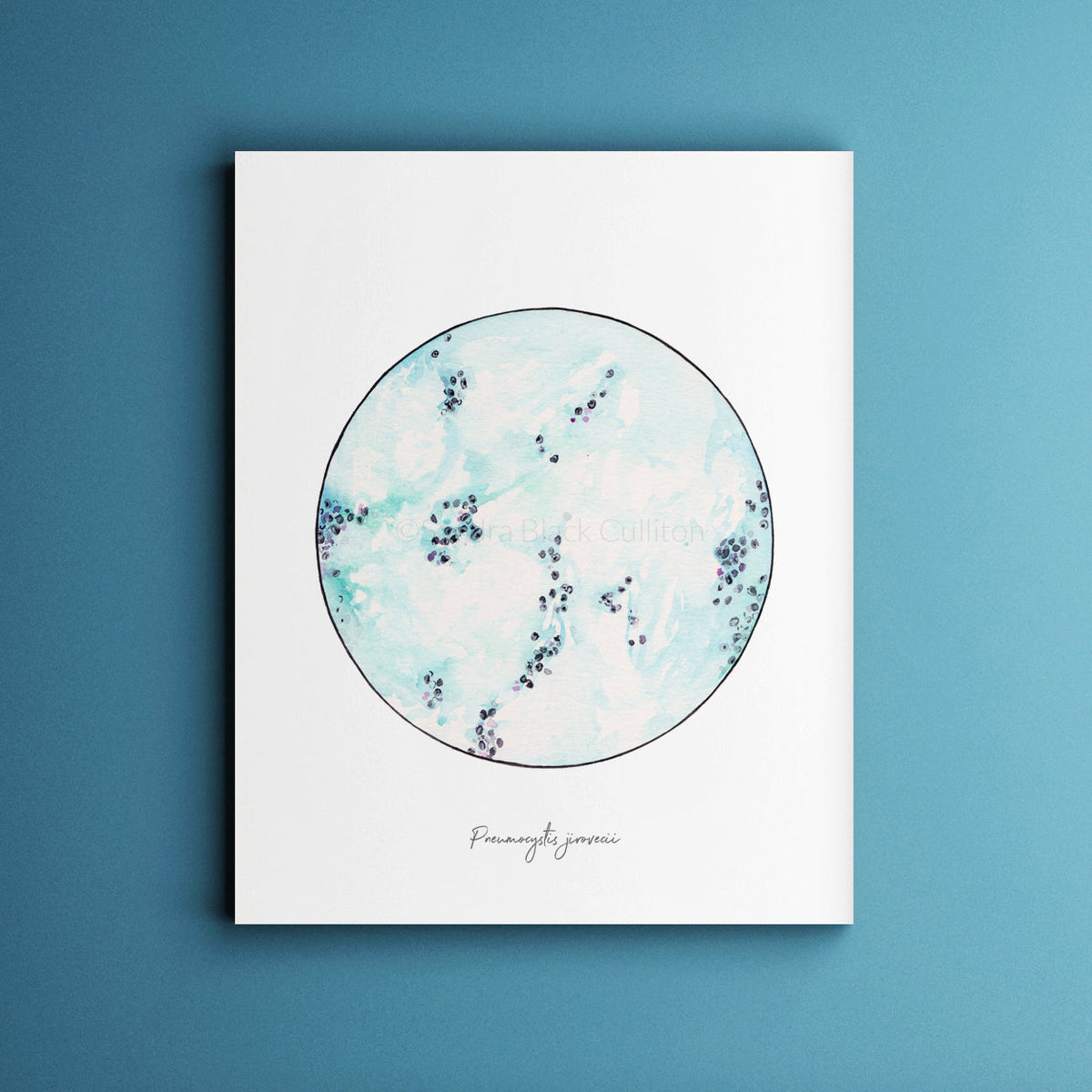 Pneumocystis jirovici print