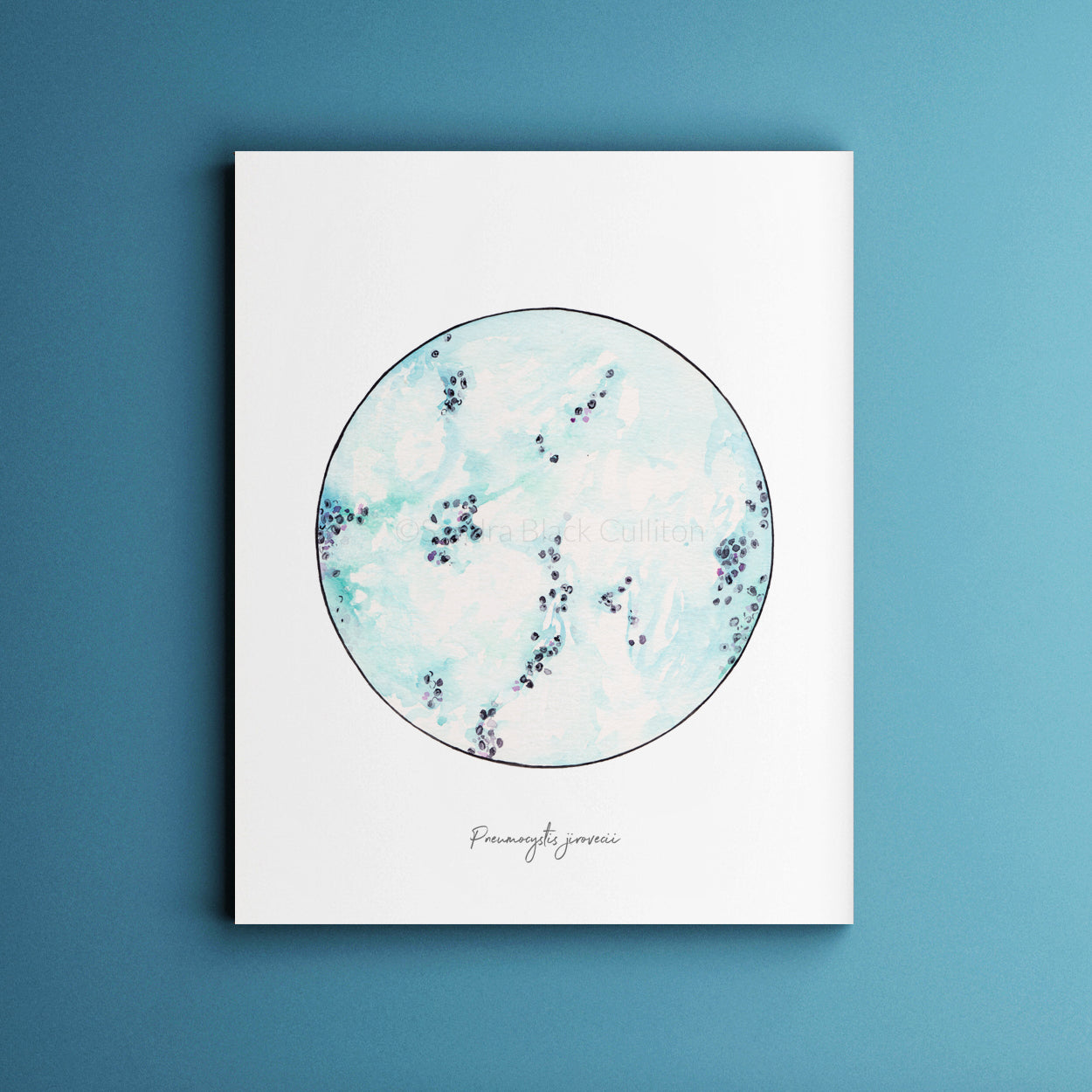 Pneumocystis jirovici print